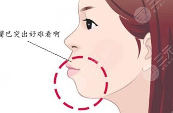 凸嘴
