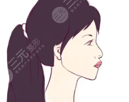凸嘴