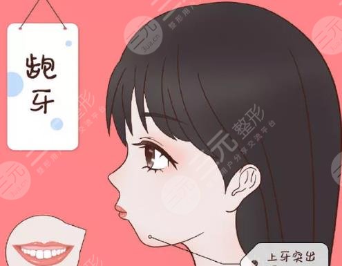 凸嘴矯正