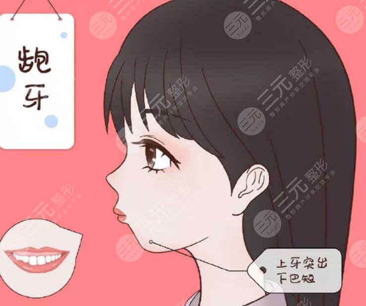 凸嘴