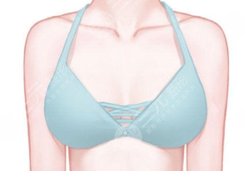 上海九醫(yī)院徐華和王濤乳房再造哪個好