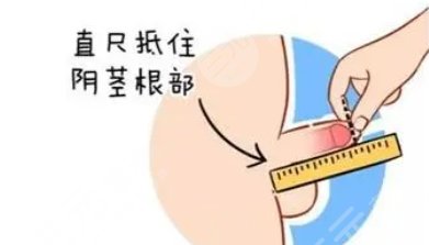 增粗手術(shù)