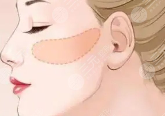 顴骨
