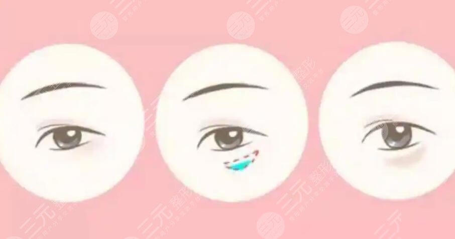 臥蠶