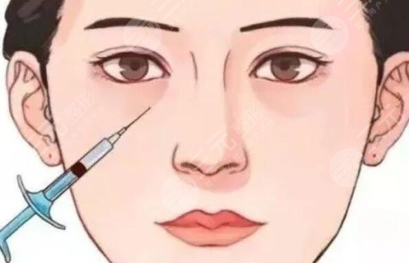 脂肪填充