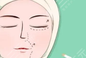 拉皮