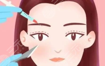 雙眼皮