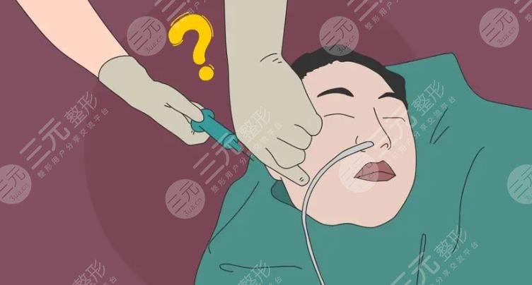 面部填充