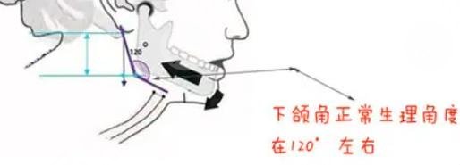 下頜角