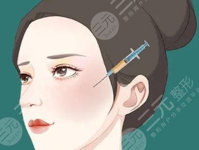 脂肪填充