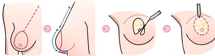 巨乳