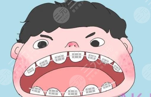 牙齒矯正