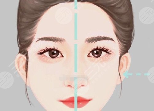 顴骨