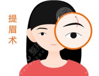 切眉