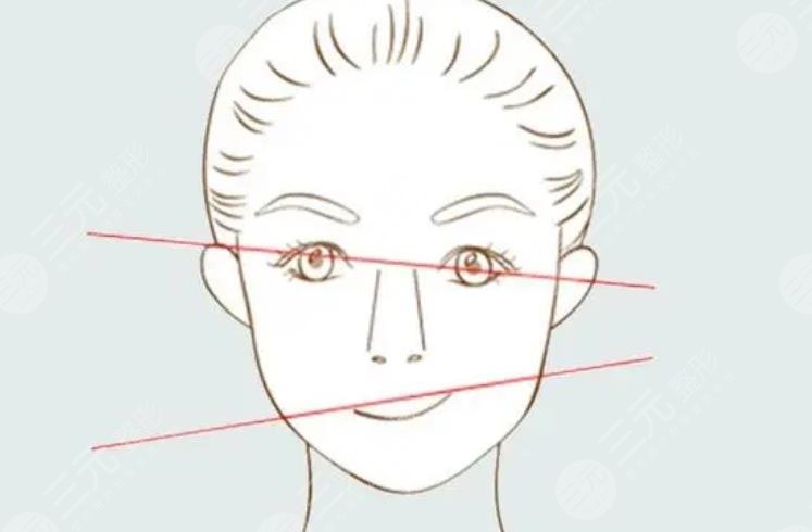 面部輪廓