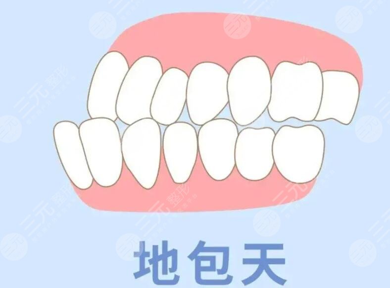 地包天
