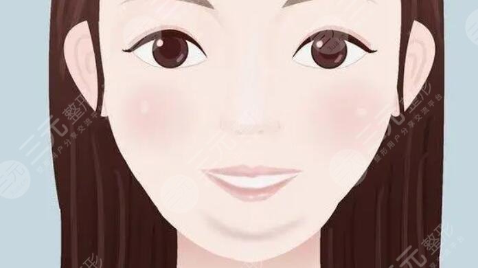雙下巴
