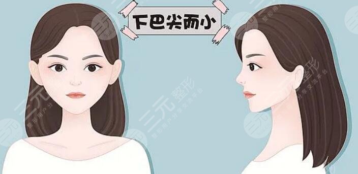 豐下巴