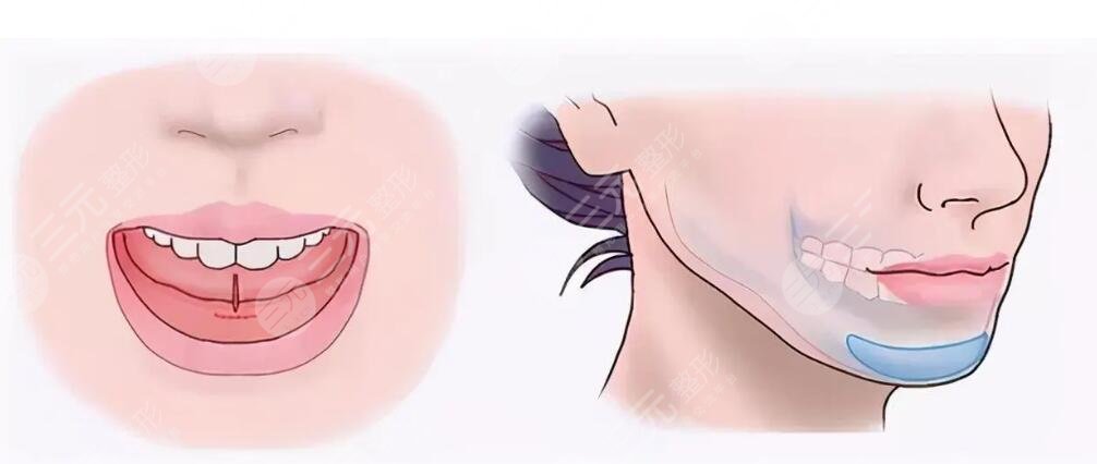 下巴