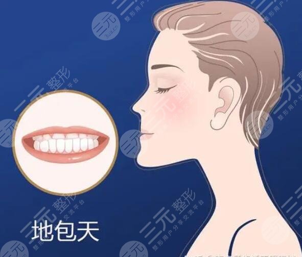 地包天矯正