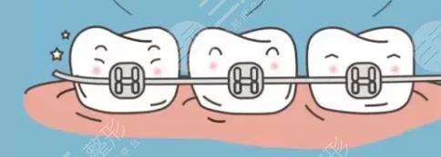 牙齒矯正