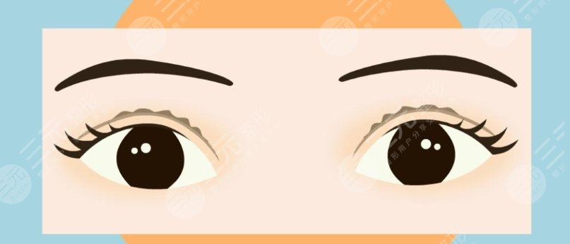雙眼皮