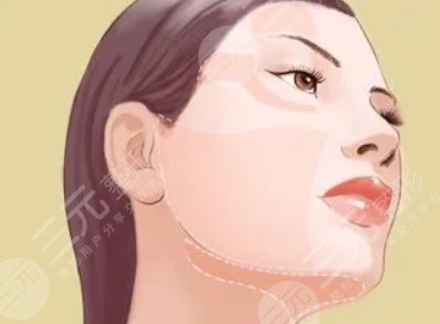 填充