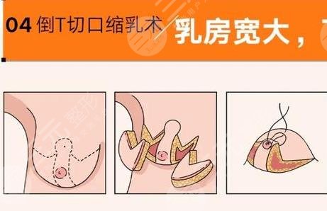 巨乳