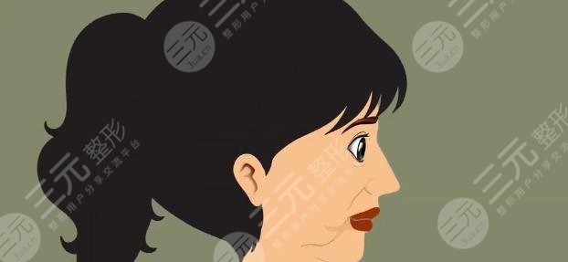 拉皮手術(shù)