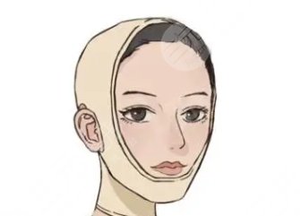 面部吸脂