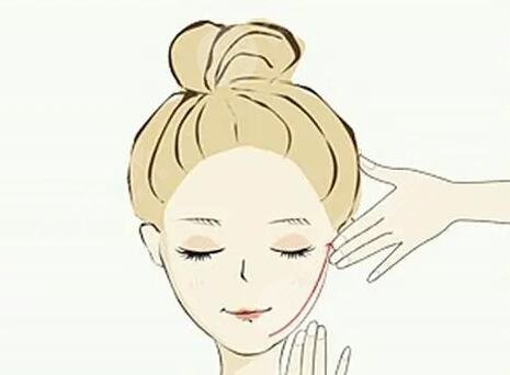 頦成型