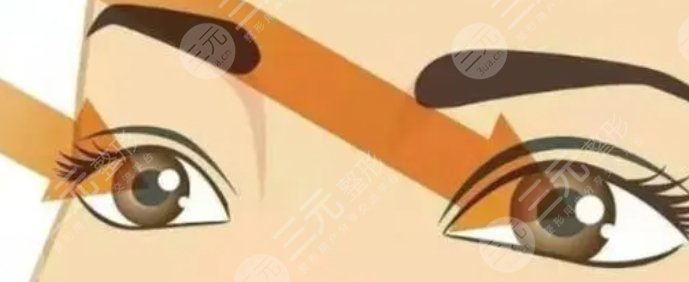 雙眼皮