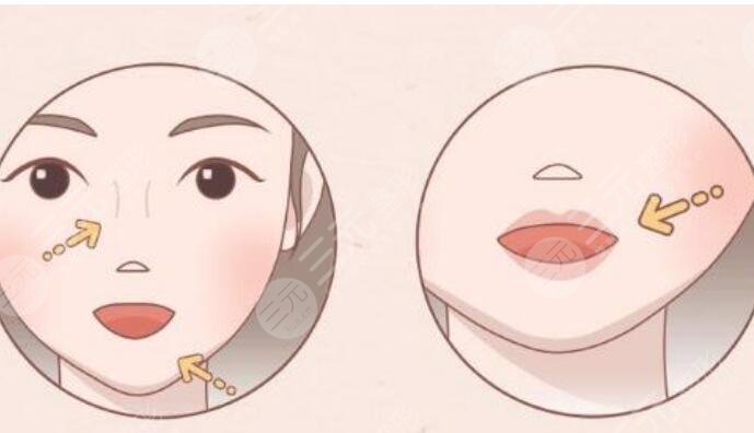 豐唇
