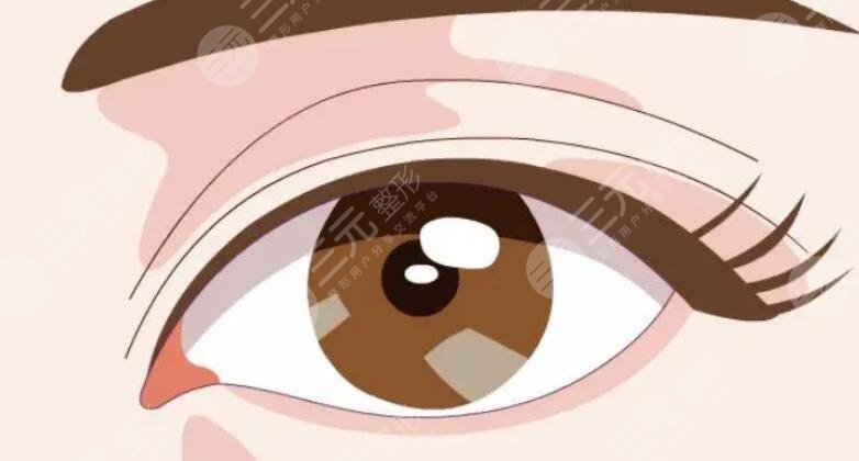 開眼角