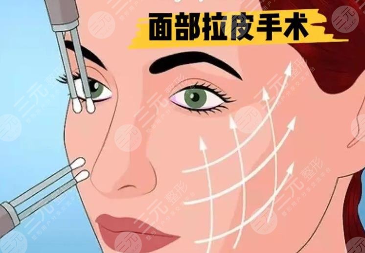 拉皮手術