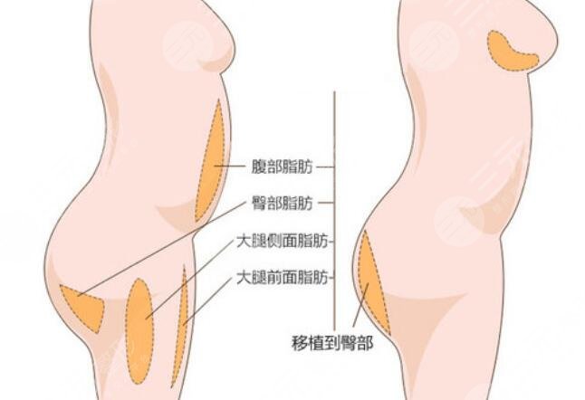 豐臀