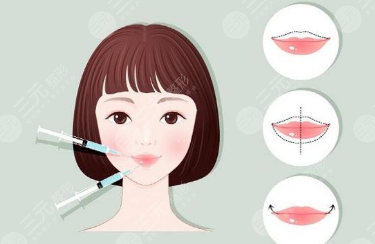 厚唇改薄