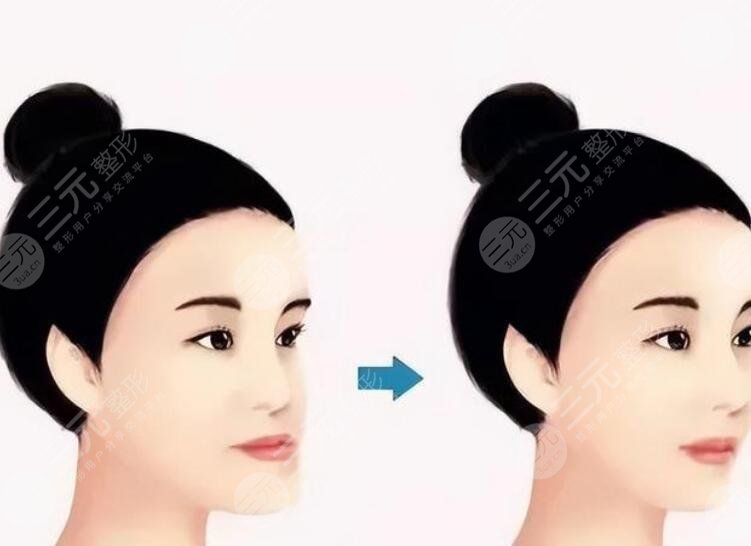 正頜