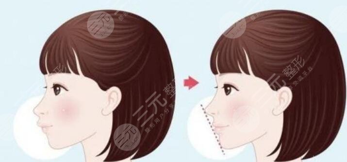 正頜