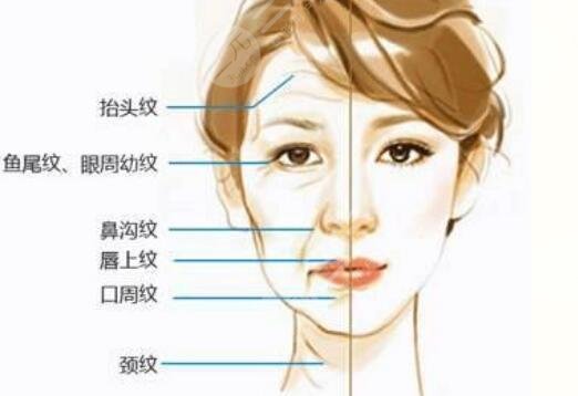 抗衰