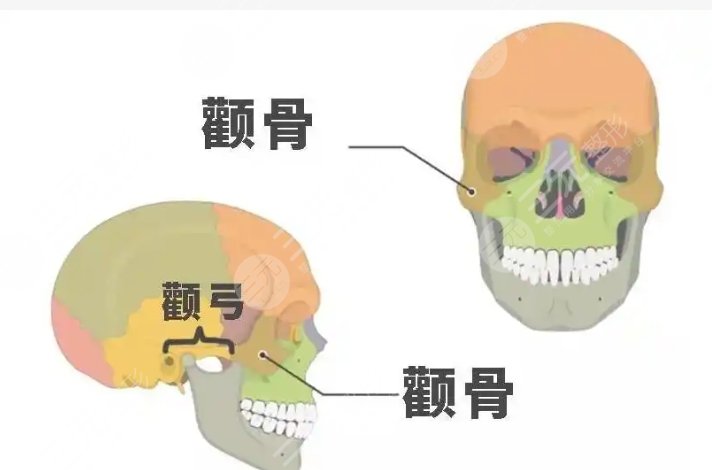 顴骨