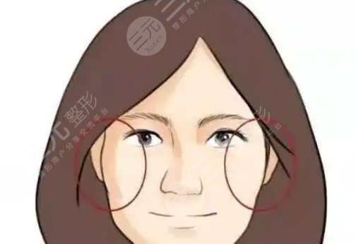 顴骨