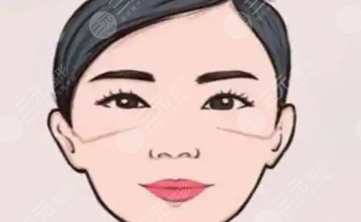 顴骨