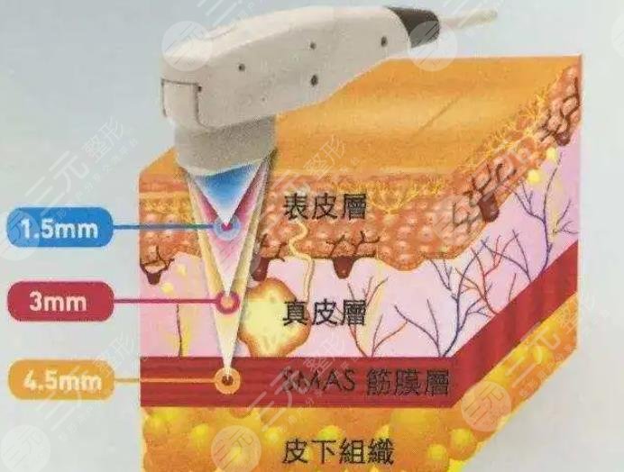 除皺