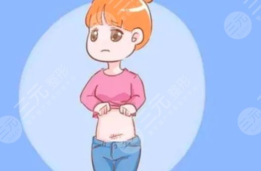 腹壁