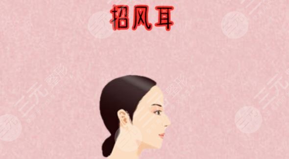招風(fēng)耳整形