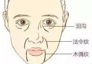 懸吊除皺