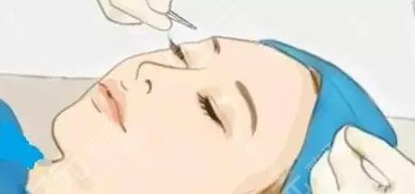 雙眼皮