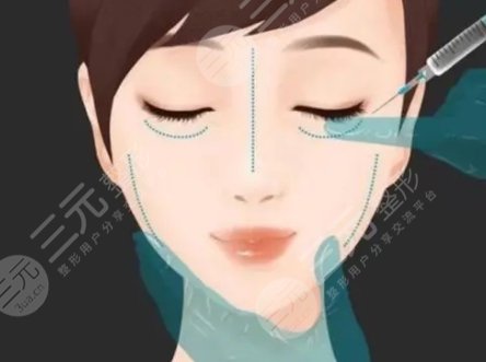 注射