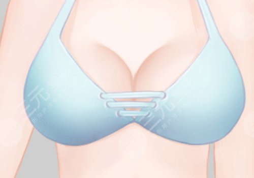 北京協(xié)和曾昂豐胸價(jià)格
